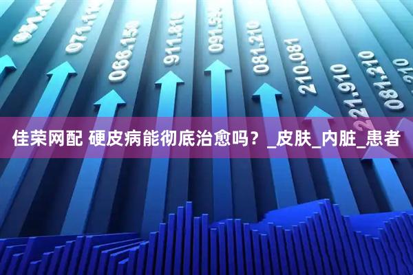 佳荣网配 硬皮病能彻底治愈吗？_皮肤_内脏_患者